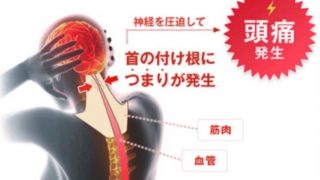 大分別府 頭痛専門ここまろ調整院