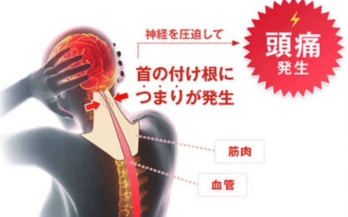 大分別府 頭痛専門ここまろ調整院